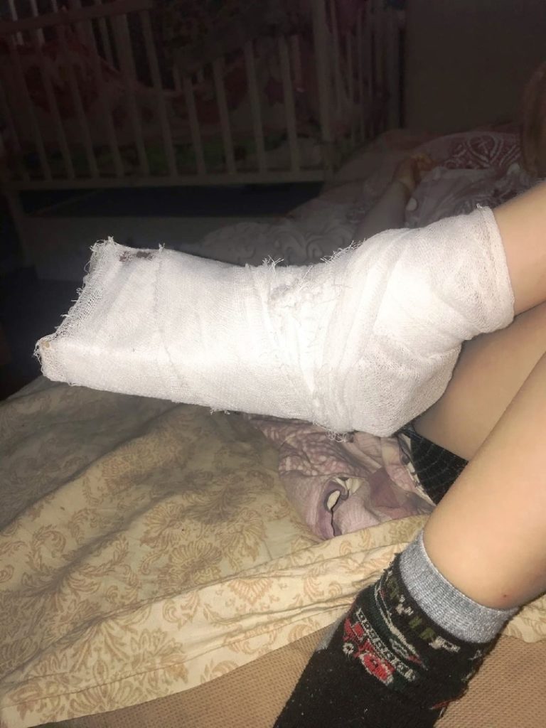 В Нижнем Тагиле четырёхлетний мальчик получил тяжёлую травму, катаясь на «советской» карусели