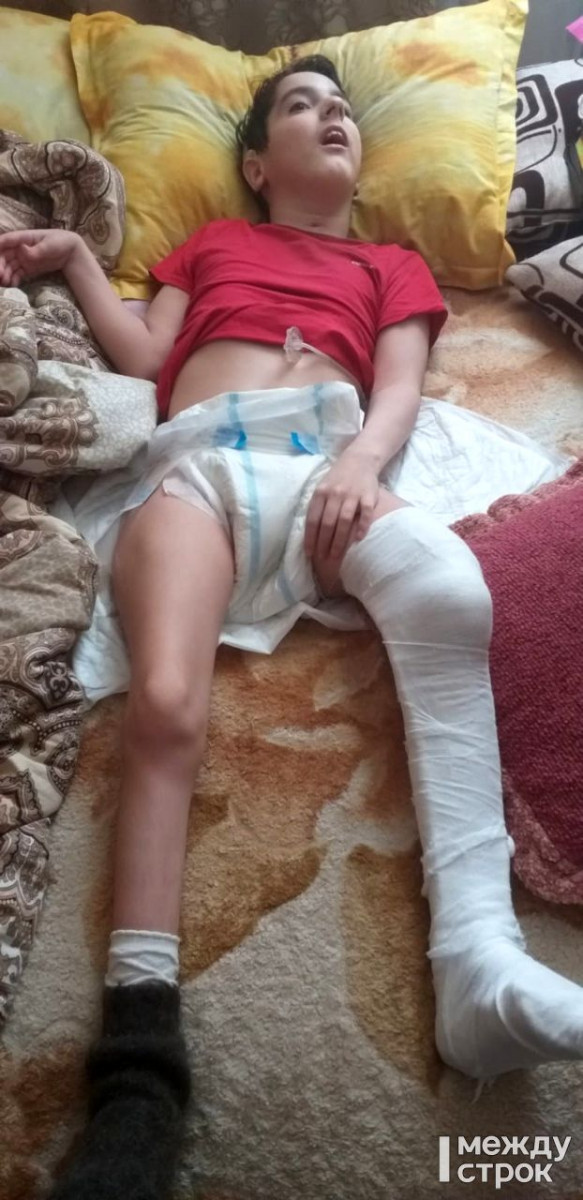 Жительница Нижнего Тагила обвиняет специалиста ЛФК в том, что он сломал ногу её 13-летнему сыну-инвалиду, а полицию — в затягивании расследования уголовного дела 